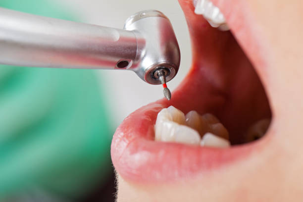 Best Emergency Dentist for Knocked-Out Tooth in Chicago, IL
